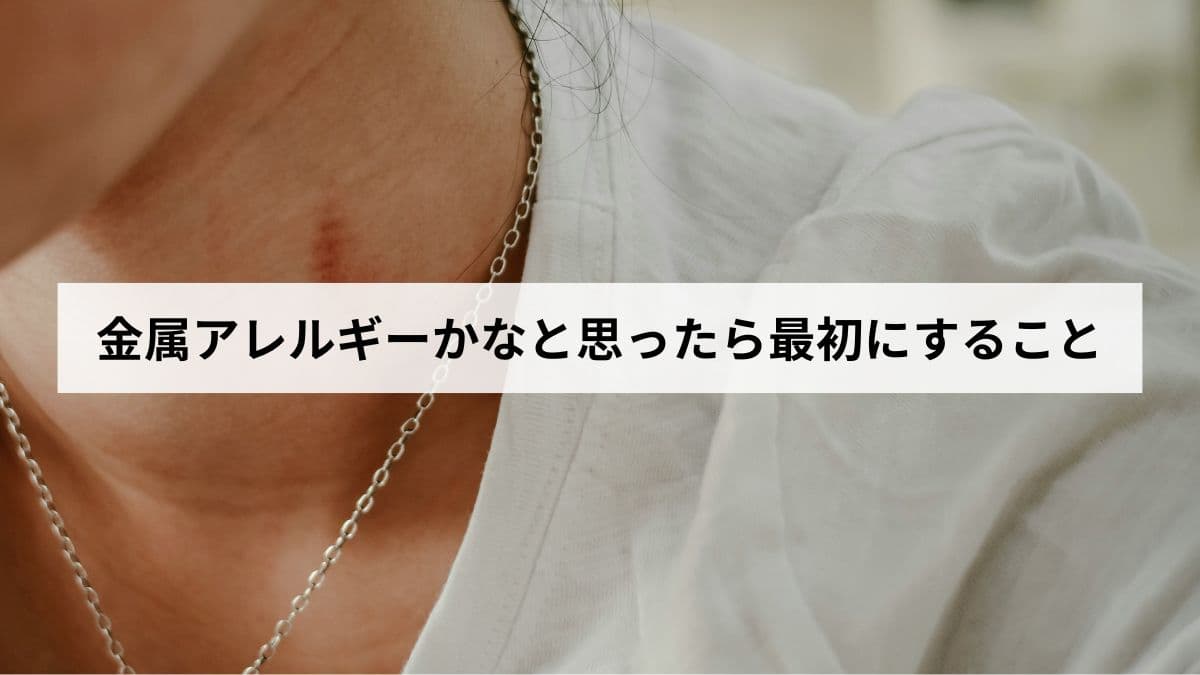 金属アレルギーかなと思ったら最初にすることは？｜症状・検査・治療・予防を解説します